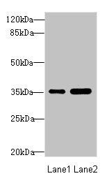 TOB2 antibody