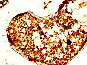 TOM1L1 antibody