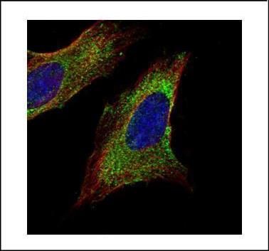 TOM1L1 antibody [C3], C-term