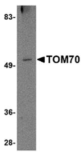 TOM70 Antibody