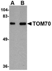 TOM70 Antibody