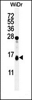 TOMM20L antibody