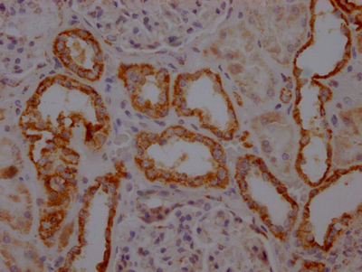 TOMM22 Recombinant Monoclonal Antibody
