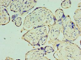 TOMM40 Antibody