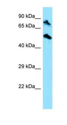 TOP1MT antibody