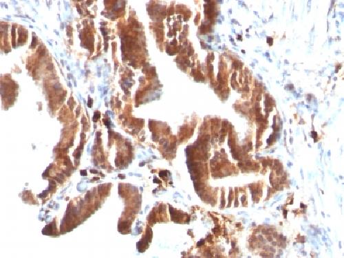Topoisomerase I, Mitochondrial (TOP1MT) Antibody