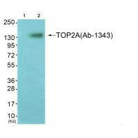 TOP2A (Ab-1343) antibody