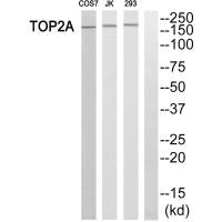 TOP2A antibody