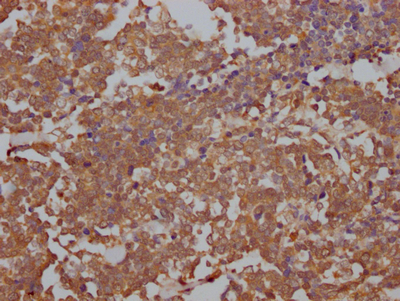TOP2A Recombinant Monoclonal Antibody