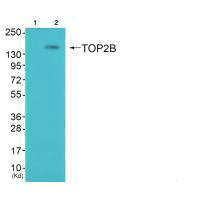 TOP2B antibody
