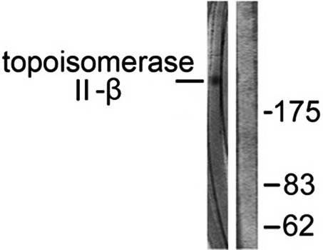 TOP2B antibody