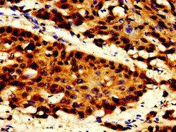 TOP2B Antibody