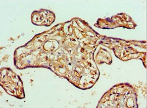 TOPBP1 Antibody
