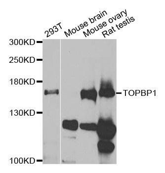TOPBP1 antibody