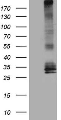 Topoisomerase I (TOP1) antibody