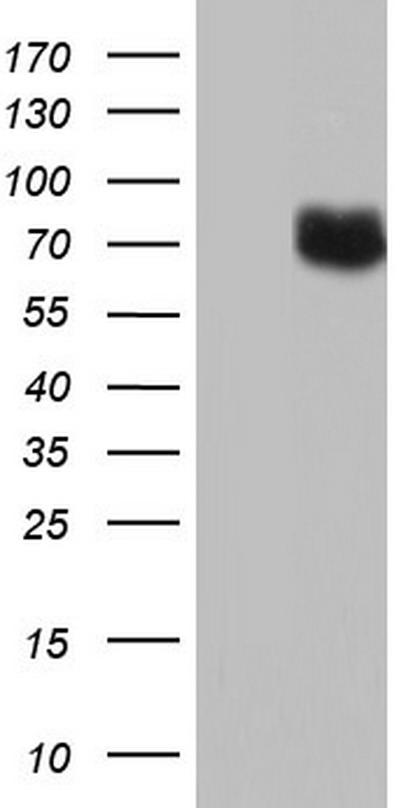Topoisomerase II alpha (TOP2A) antibody