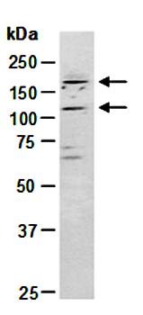 TOPORS (C) Antibody, Rabbit Polyclonal