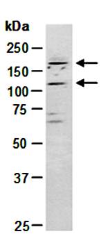 TOPORS antibody