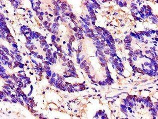 TOR1A Antibody