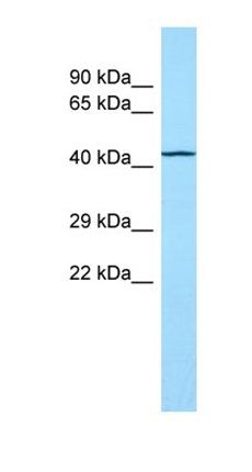TOR1AIP2 antibody