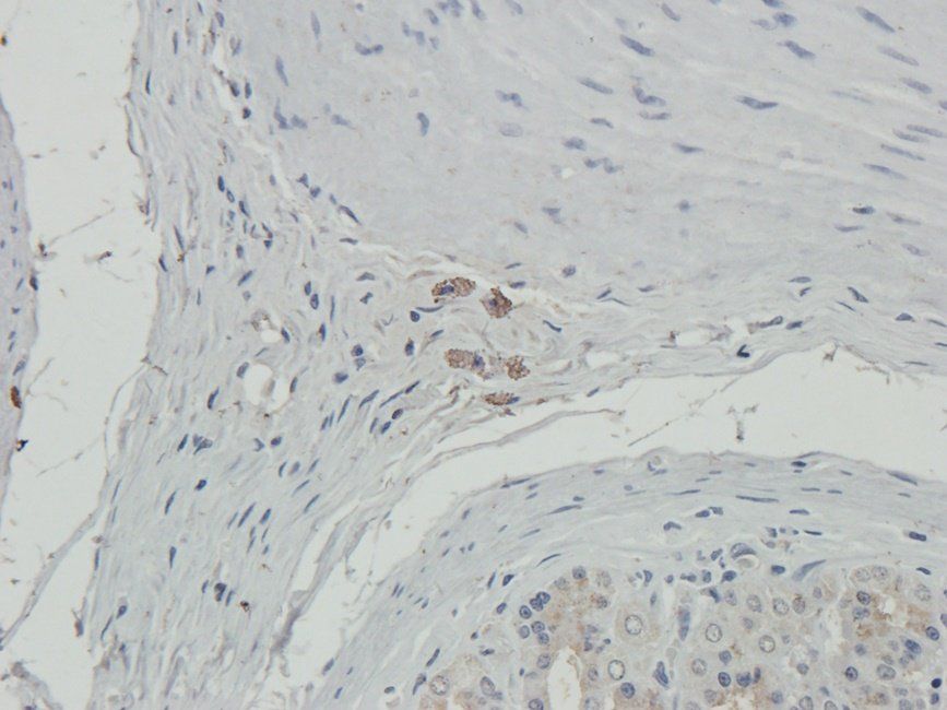 TOR1B antibody