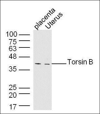 Torsin B antibody