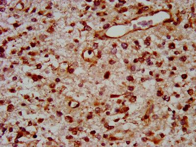 TOX Antibody