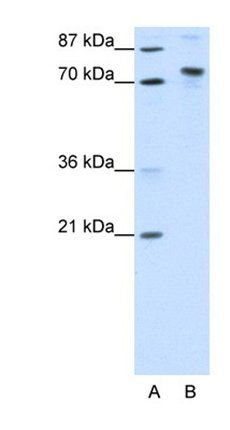 TOX4 antibody