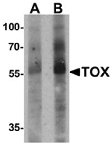 TOX Antibody
