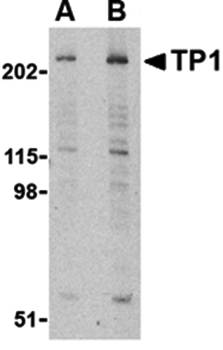 TP1 Antibody