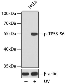 TP53 (Phospho-S6) antibody