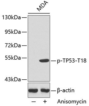 TP53 (Phospho-T18) antibody