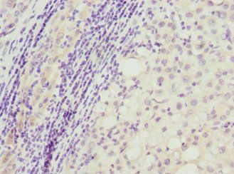 TP53AIP1 Antibody