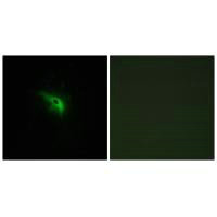TP53AIP1 Antibody