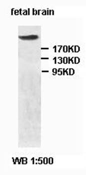TP53BP1 antibody