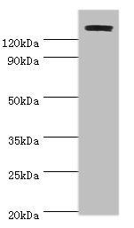 TP53BP2 Antibody