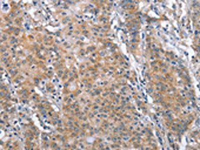 TP53BP2 Antibody