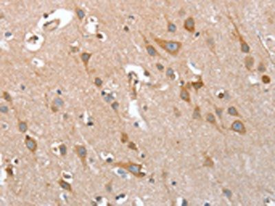 TP53BP2 Antibody