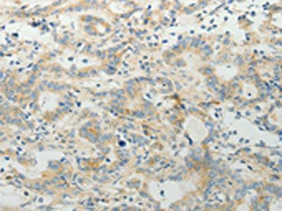 TP53BP2 Antibody