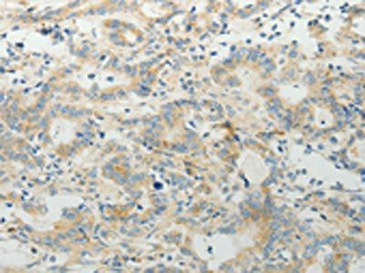 TP53BP2 antibody