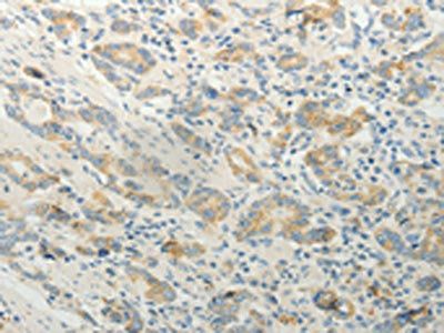 TP53BP2 Antibody