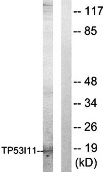 TP53I11 antibody