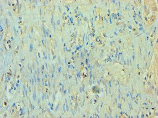 TP53I3 Antibody