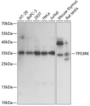 TP53RK antibody