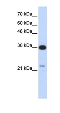 TP53TG5 antibody