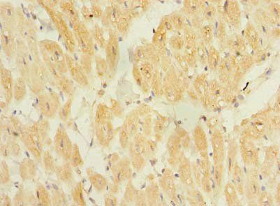 TP53TG5 Antibody