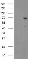 TP73-AS1 antibody
