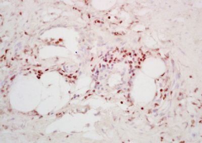 TPD52 Rabbit Polyclonal Antibody