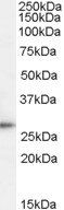 Goat anti-TPD52 Antibody