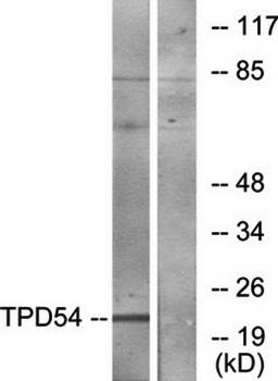TPD54 antibody